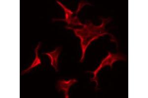 ABIN6267678 staining HepG2 by IF/ICC. (ESR2 抗体  (pSer105))