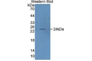 Western blot analysis of the recombinant protein. (PTPRN2 抗体  (AA 839-1015))
