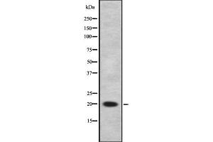 Western blot analysis of CITED1 using Jurkat whole  lysates.