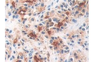 Immunohistochemistry (IHC) image for anti-Folate Hydrolase (Prostate-Specific Membrane Antigen) 1 (FOLH1) (AA 274-587) antibody (ABIN7443569)