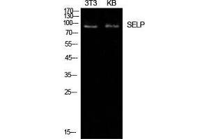 Western Blot (WB) analysis of NIH-3T3, KB cells using P-Selectin Polyclonal Antibody. (P-Selectin 抗体  (Internal Region))