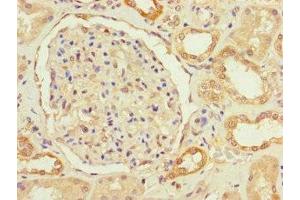 Immunohistochemistry of paraffin-embedded human kidney tissue using ABIN7166759 at dilution of 1:100 (FBXO11 抗体  (AA 181-453))