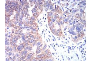 Immunohistochemistry (IHC) image for anti-Tubulin Folding Cofactor C (TBCC) (AA 1-196) antibody (ABIN5542597)