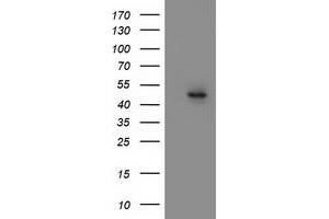 Western Blotting (WB) image for anti-Mitochondrial Methionyl-tRNA Formyltransferase (MTFMT) (AA 175-389) antibody (ABIN1491020) (MTFMT 抗体  (AA 175-389))