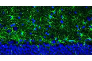 Representative section of formalin fixed, paraffin-embedded rat brain hippocampus region showing staining of GFAP. (GFAP 抗体  (AA 411-422))