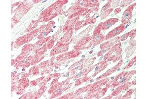 Human Heart: Formalin-Fixed, Paraffin-Embedded (FFPE). (PDE4B 抗体  (AA 467-516))