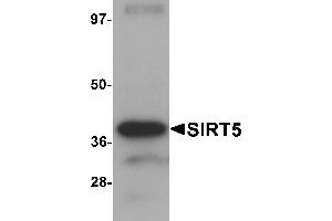 Western blot analysis of SIRT5 in human liver tissue lysate with SIRT5 antibody at 1 µg/mL. (SIRT5 抗体  (C-Term))