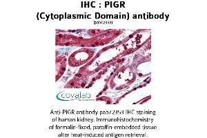 Image no. 1 for anti-Polymeric Immunoglobulin Receptor (PIGR) (Cytoplasmic Domain) antibody (ABIN1738096) (PIGR 抗体  (Cytoplasmic Domain))