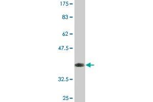 Western Blot detection against Immunogen (37. (ZBTB25 抗体  (AA 331-435))