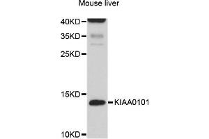 Western blot analysis of extracts of Mouse liver cells, using KIAA0101 antibody. (KIAA0101 抗体)
