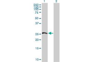 Western Blot analysis of PSMA8 expression in transfected 293T cell line by PSMA8 MaxPab polyclonal antibody. (PSMA8 抗体  (AA 1-250))