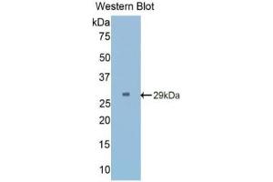 Western blot analysis of the recombinant protein. (Angiopoietin 2 抗体  (AA 269-496))