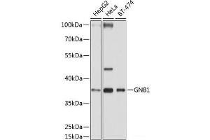 Western blot analysis of extracts of various cell lines using GNB1 Polyclonal Antibody at dilution of 1:1000. (GNB1 抗体)