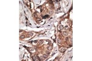 Image no. 2 for anti-HtrA Serine Peptidase 1 (HTRA1) (AA 389-419), (C-Term) antibody (ABIN356844) (HTRA1 抗体  (C-Term))