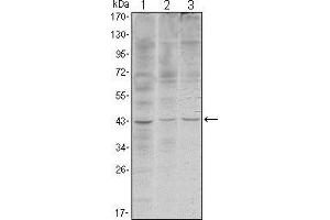 Western blot analysis using WIF1 mouse mAb against Hela (1), NIH/3T3 (2) and NTERA-2 (3) cell lysate. (WIF1 抗体)