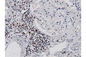 Immunohistochemical staining of paraffin-embedded Human Kidney tissue using anti-MSI1 mouse monoclonal antibody. (MSI1 抗体)