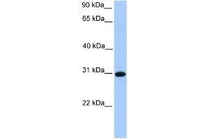 ETFB antibody used at 1 ug/ml to detect target protein. (ETFB 抗体  (C-Term))