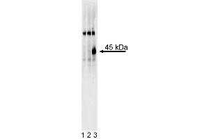 Western blot analysis of Sox17 in definitive endoderm derived from human embryonic stem (ES) cells. (SOX17 抗体)