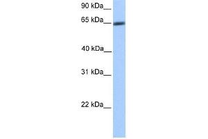 Transfected 293T; WB Suggested Anti-ZNF449 Antibody Titration: 0. (ZNF449 抗体  (N-Term))