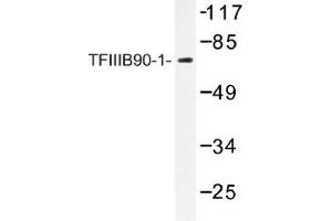 Image no. 1 for anti-BRF1, RNA polymerase III transcription initiation factor subunit (BRF1) antibody (ABIN317615) (BRF1 抗体)