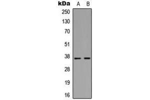 Western blot analysis of MMP10 expression in Jurkat (A), HepG2 (B) whole cell lysates. (MMP10 抗体  (C-Term))