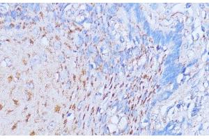 Immunohistochemistry of paraffin-embedded Human esophageal using NME6 Polyclonal Antibody at dilution of 1:100 (40x lens). (NME6 抗体)