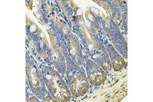 Immunohistochemistry of paraffin-embedded mouse intestine using EIF3C Antibody. (EIF3C 抗体  (AA 694-913))