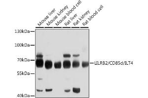 Western blot analysis of extracts of various cell lines, using LILRB2/CD85d/ILT4 antibody (ABIN6131861, ABIN6143217, ABIN6143219 and ABIN6214278) at 1:1000 dilution. (LILRB2 抗体)