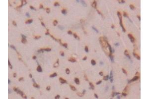 Immunohistochemistry (IHC) image for anti-Fatty Acid Binding Protein 4, Adipocyte (FABP4) (AA 2-132) antibody (ABIN7436912)