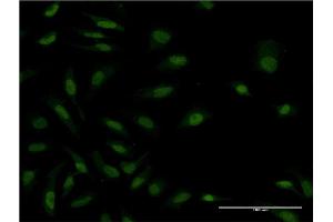 Immunofluorescence (IF) image for anti-Mitogen-Activated Protein Kinase Kinase Kinase MLT (ZAK) (AA 1-120) antibody (ABIN565679)