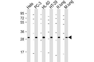 Western Blot at 1:2000 dilution Lane 1: Hela whole cell lysate Lane 2: PC-3 whole cell lysate Lane 3: HL-60 whole cell lysate Lane 4: HT-29 whole cell lysate Lane 5: rat lung lysate Lane 6: mouse lung lysate Lysates/proteins at 20 ug per lane. (RPS4X 抗体  (AA 209-243))