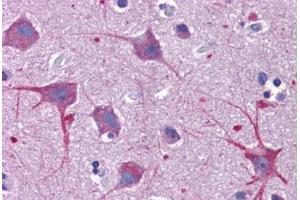 Human Brain, Cortex: Formalin-Fixed, Paraffin-Embedded (FFPE) (SKA1 抗体  (C-Term))