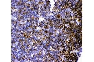 IHC-P: MCAK antibody testing of rat thymus tissue (KIF2C 抗体  (AA 531-725))