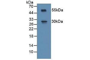 Detection of RSPO1 in Mouse Spinal Cord Tissue using Polyclonal Antibody to R-Spondin 1 (RSPO1) (RSPO1 抗体  (AA 21-135))