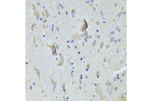 Immunohistochemistry of paraffin-embedded rat spinal cord using SARS Antibody (ABIN5974071) at dilution of 1/100 (40x lens). (Seryl-tRNA Synthetase (SARS) 抗体)