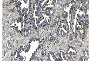 ABIN334371 (8µg/ml) staining of paraffin embedded Human Prostate. (CEP290 抗体  (Internal Region))