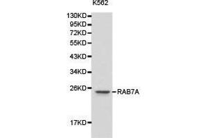 Western Blotting (WB) image for anti-RAB7A, Member RAS Oncogene Family (RAB7A) antibody (ABIN1874518) (RAB7A 抗体)