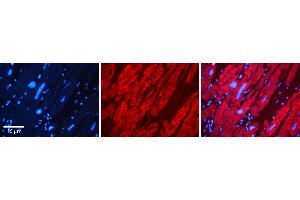 Rabbit Anti-DMAP1 Antibody   Formalin Fixed Paraffin Embedded Tissue: Human heart Tissue Observed Staining: Cytoplasmic Primary Antibody Concentration: 1:100 Other Working Concentrations: N/A Secondary Antibody: Donkey anti-Rabbit-Cy3 Secondary Antibody Concentration: 1:200 Magnification: 20X Exposure Time: 0. (DMAP1 抗体  (N-Term))