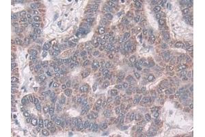Immunohistochemistry (IHC) image for anti-Coxsackie Virus and Adenovirus Receptor (CXADR) (AA 20-229) antibody (ABIN7441556)