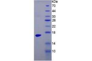 SDS-PAGE of Protein Standard from the Kit (Highly purified E. (TTR ELISA 试剂盒)