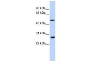 Image no. 1 for anti-Zinc Finger Protein 556 (ZNF556) (AA 36-85) antibody (ABIN6740460) (ZNF556 抗体  (AA 36-85))