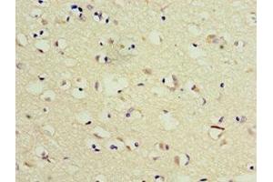 Immunohistochemistry of paraffin-embedded human brain tissue using ABIN7173541 at dilution of 1:100 (TSEN2 抗体  (AA 1-220))