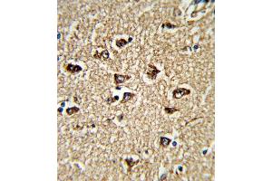 Formalin-fixed and paraffin-embedded human brain tissue reacted with BICC1 Antibody (N-term), which was peroxidase-conjugated to the secondary antibody, followed by DAB staining. (BICC1 抗体  (N-Term))