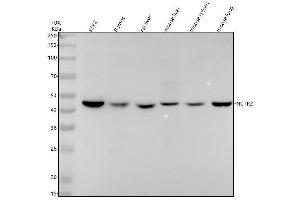 Western blot analysis of NCTR2 using anti-NCTR2 antibody (ABIN7605669).