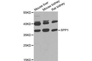 Western blot analysis of extracts of various cell lines, using SPP1 antibody (ABIN1874927) at 1:1000 dilution. (Osteopontin 抗体)