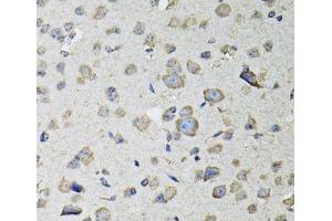Immunohistochemistry of paraffin-embedded Mouse brain using RASSF1 Polyclonal Antibody at dilution of 1:100 (40x lens). (RASSF1 抗体)