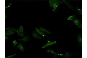 Immunofluorescence of monoclonal antibody to GPC5 on HeLa cell. (GPC5 抗体  (AA 1-572))
