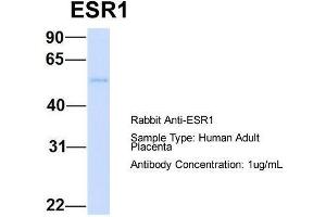 Host: Rabbit  Target Name: ESR1  Sample Tissue: Human Adult Placenta  Antibody Dilution: 1. (Estrogen Receptor alpha 抗体  (C-Term))