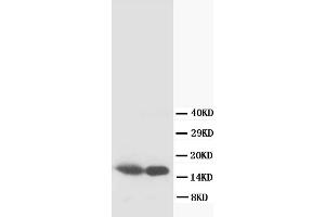Western Blotting (WB) image for anti-S100 Calcium Binding Protein B (S100B) antibody (ABIN1108929) (S100B 抗体)
