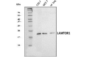 Western blot analysis of LAMTOR1 using anti-LAMTOR1 antibody (ABIN7601249).